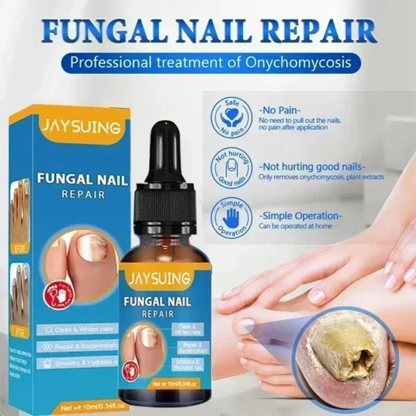 Toenail Nail Fungus Treatment Repair Fingernail Device Toenail Treatment for Foot Nail Fungus Essential Oil Onychomycosis Care - Image 4
