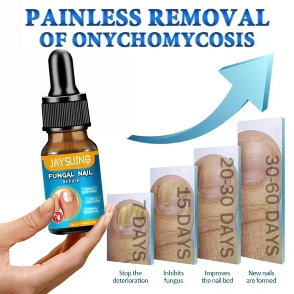 Toenail Nail Fungus Treatment Repair Fingernail Device Toenail Treatment for Foot Nail Fungus Essential Oil Onychomycosis Care - Image 2