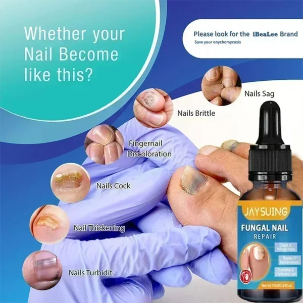Toenail Nail Fungus Treatment Repair Fingernail Device Toenail Treatment for Foot Nail Fungus Essential Oil Onychomycosis Care - Image 5
